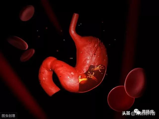 网上说幽门螺杆菌是胃癌的元凶，我查出来阳性，但没有症状，会不会得胃癌？要不要治疗？