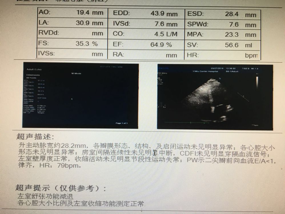心梗后心衰如何管理？新型心衰药物带来全新突破
