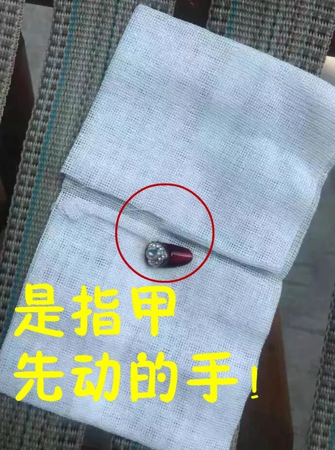 小男孩把西瓜子呛进肺,一岁多宝宝吃西瓜被呛到抢救