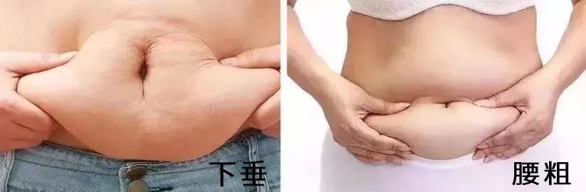 告别“大腹婆”，立变“小腰精”！穿上它，躺着拥有平坦小腹