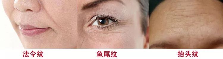 解决皱纹色斑粗糙干燥就用这一套,淡化各种皱纹特别快的好方法