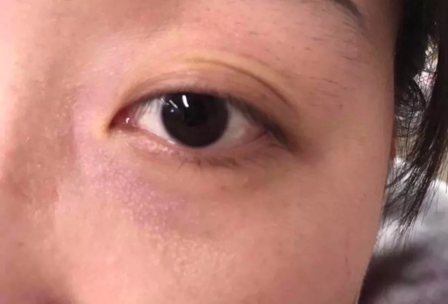 解决皱纹色斑粗糙干燥就用这一套,淡化各种皱纹特别快的好方法