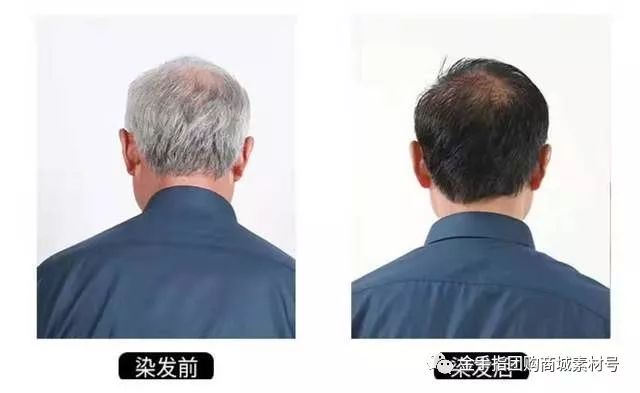 金手指官方旗舰店直播,金手指9.9团购