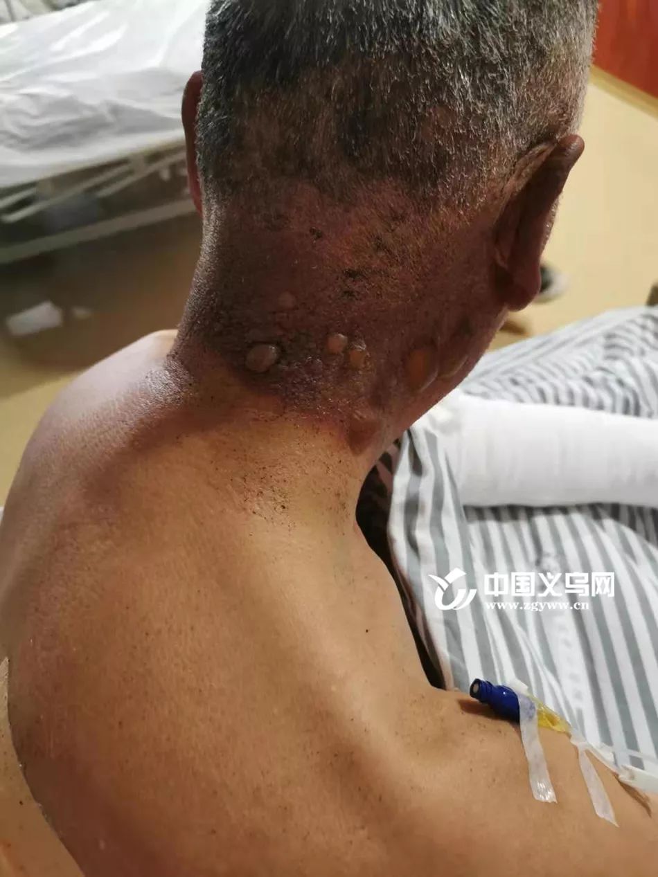 义乌城西着火最新消息,村民家中起火干群已紧急扑救