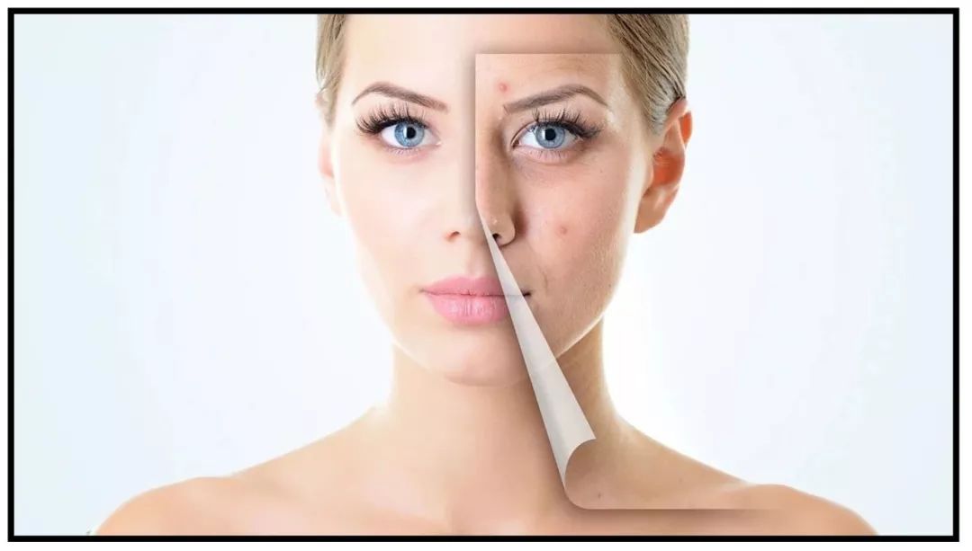 皮肤科医生护肤简单,皮肤科医生各种药膏的护肤作用