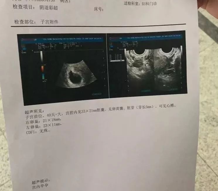 月经干净第1天同房，女朋友肚子里的孩子是不是他的？