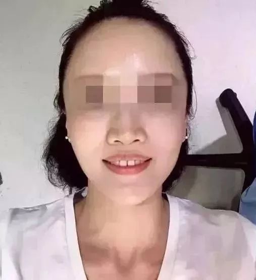 福州市民凭身份证免费牙齿矫正,身份证520开头免票