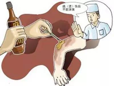 心疼！菏泽一月嫂抱仅40天男婴做饭时锅中鸡蛋突然爆开，孩子腿和肚皮烫出了泡...