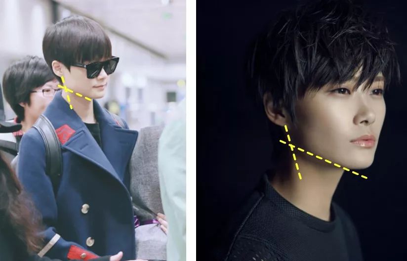 不削骨改变脸型,不削骨变脸型