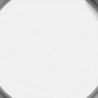 冠脉造影技术成熟不,跟我学技术分析从入门到精通