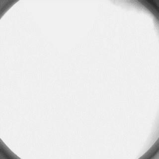 冠脉造影技术成熟不,跟我学技术分析从入门到精通