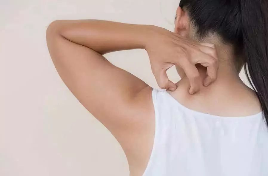 人工性荨麻疹都有什么症状,人工性荨麻疹的病因是什么