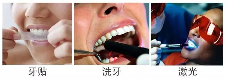 俄罗斯牙膏去黄牙怎么样,祛牙垢黄牙的牙膏国货之光