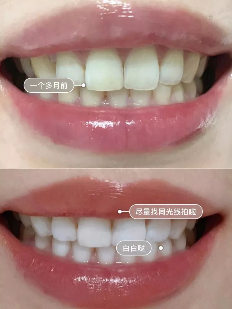 俄罗斯牙膏去黄牙怎么样,祛牙垢黄牙的牙膏国货之光