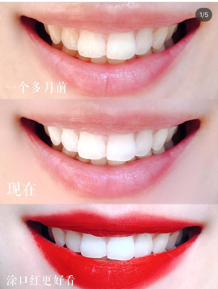 团购|俄罗斯亮白牙膏组合，轻松瓦解多年牙垢，清新口气告别黄牙