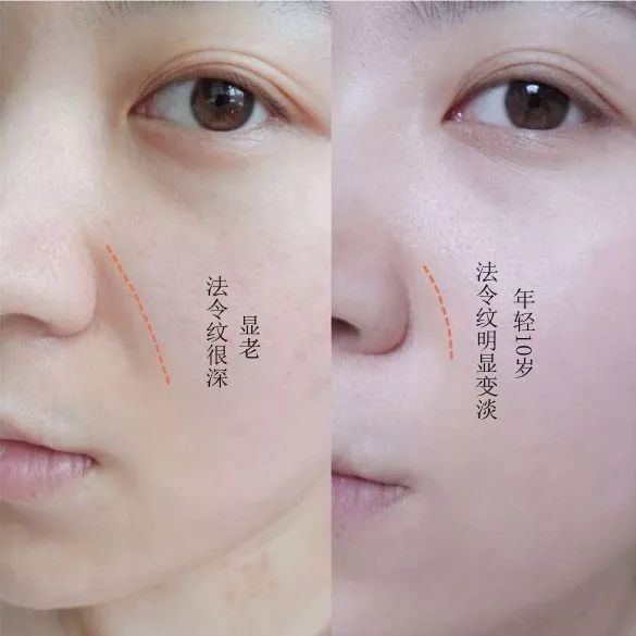 蛋白贴去皱,胶原蛋白颈纹贴