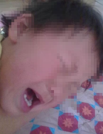 月嫂被查出梅毒,月嫂带娃第一天被查出患梅毒