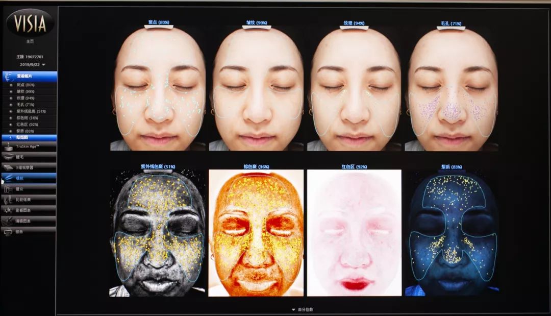 肌诊室水光肌挑战,肌诊室修复