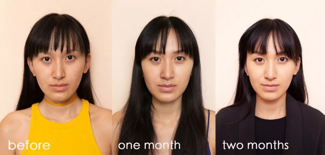 肌诊室水光肌挑战,肌诊室修复