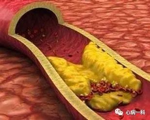 杏林微科普是什么意思,杏林微科普预防秋燥的方法