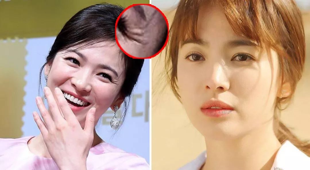 眼膜贴八小时紧致抗皱淡细纹,官方眼膜紧致抗皱淡细纹法令纹