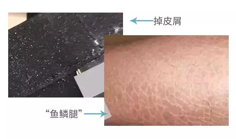 小个子女生要怎么穿衣服好看,小个子女生怎么穿1米7