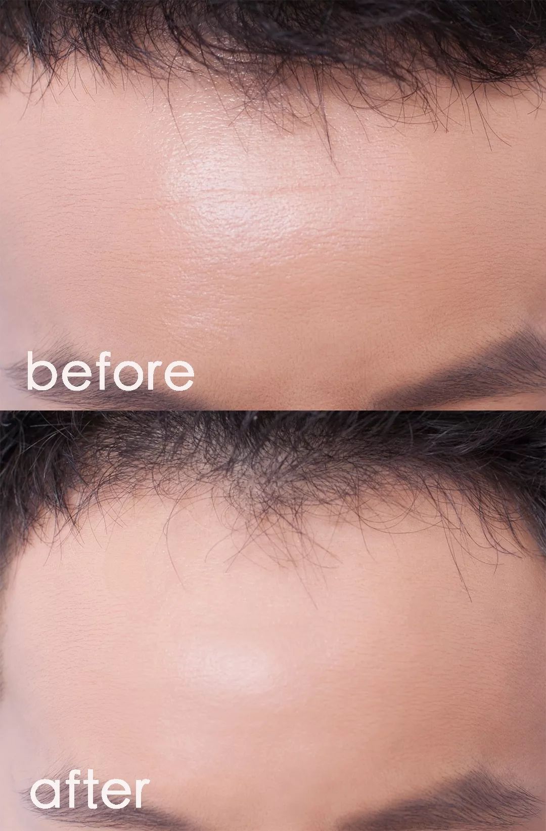 对抗岁月魔皱，护肤品能做的比你想象中更多...