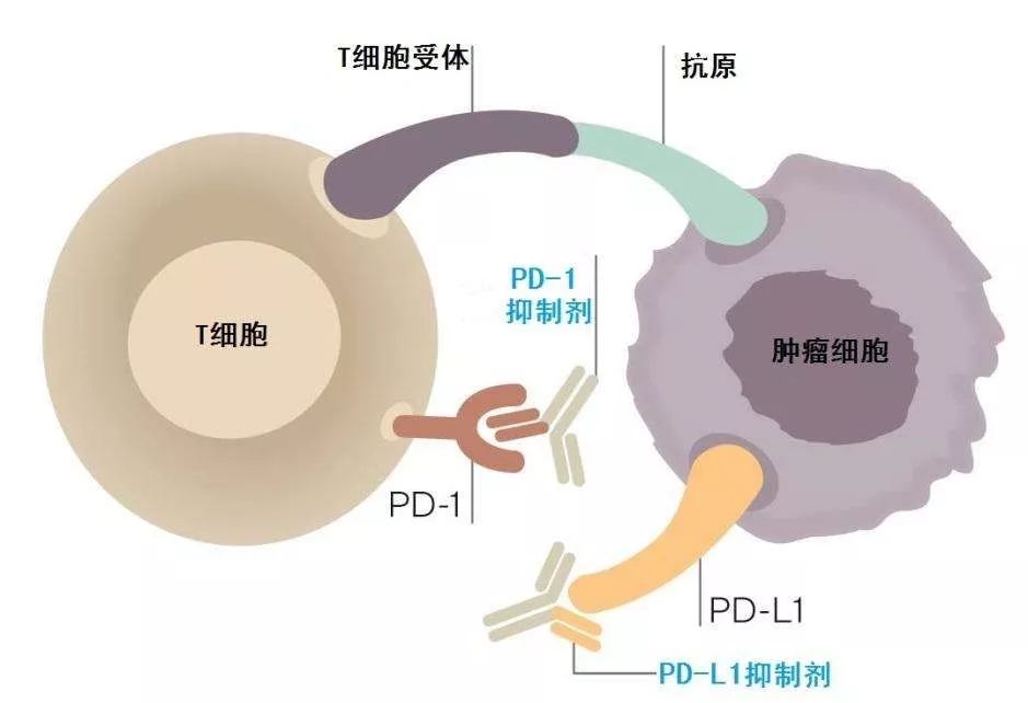 如何把冷肿瘤变成热肿瘤,肿瘤热疗新趋势热死肿瘤不伤身