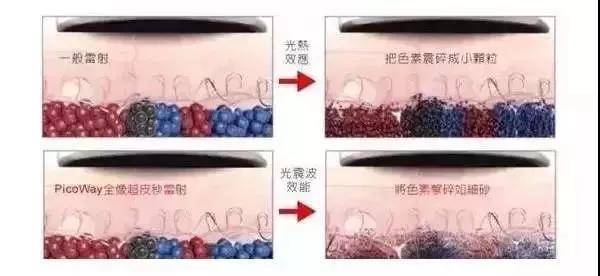 突然长了一颗斑怎么去,一颗颗的斑变成了一块斑什么原因