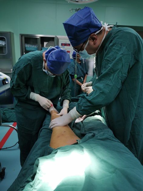 下肢静脉曲张外科手术,日喀则首例静脉曲张微创手术