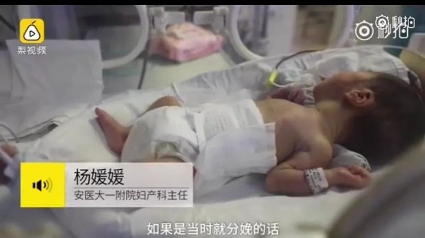 28岁孕妇死亡竟然产下一对双胞胎,安徽女子怀双胞胎后续