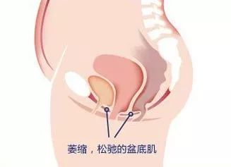 刘涛怎么做到生了两个娃还逆生长的？