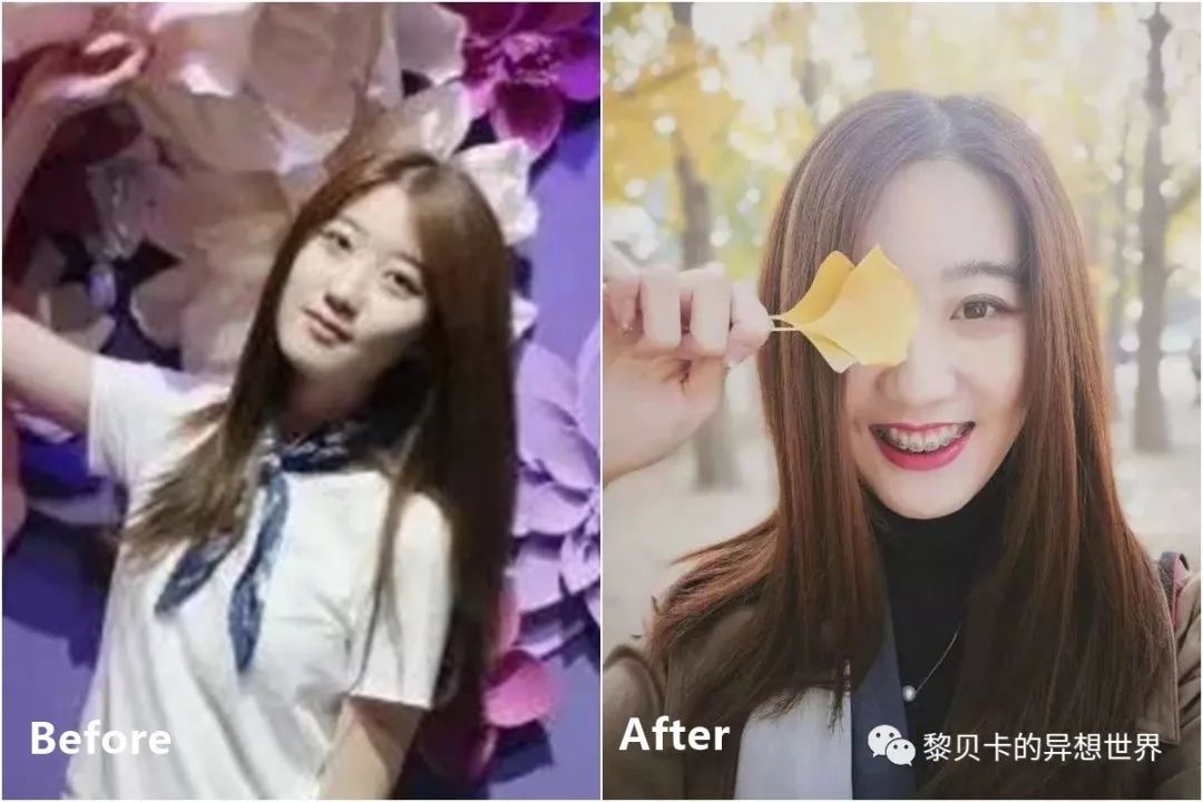 最短只要一年，这件事做对了堪比整容