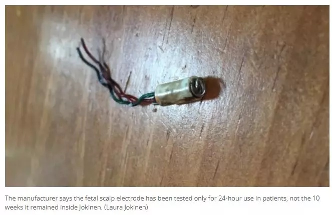 加拿大妈妈顺产生孩子,加拿大产妇生孩子