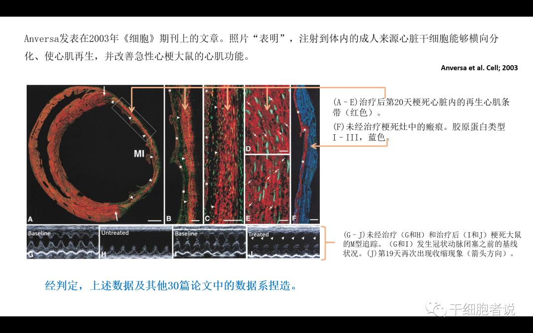 干货：干细胞治疗心血管疾病的未来（PPT）