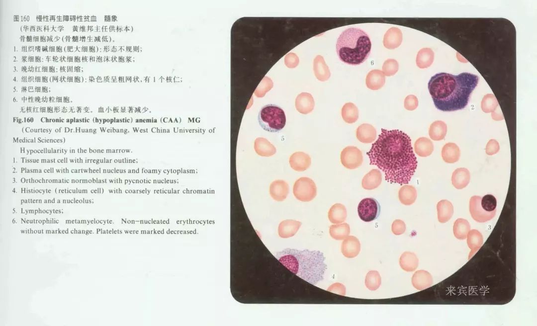 全血细胞减少疾病，你还傻傻分不清？