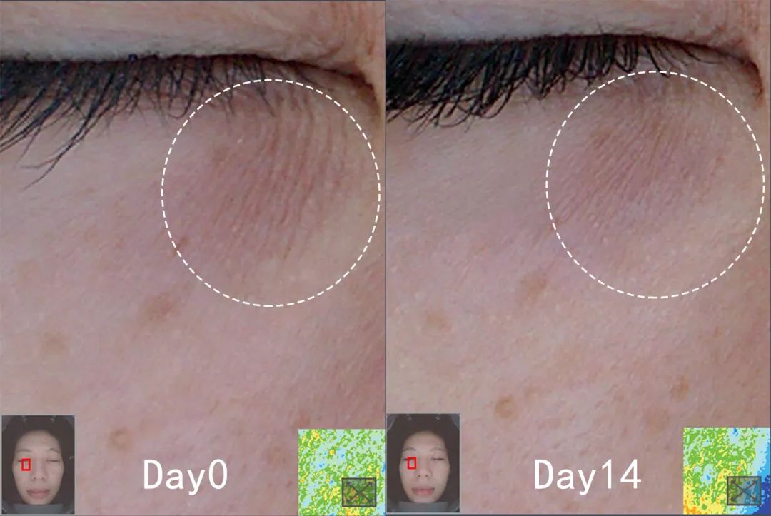 盲测|微整不急!先试试黑科技抗老面霜