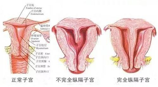 雅安恒博妇产医院技术好吗,雅安市恒博医院妇产科好不好