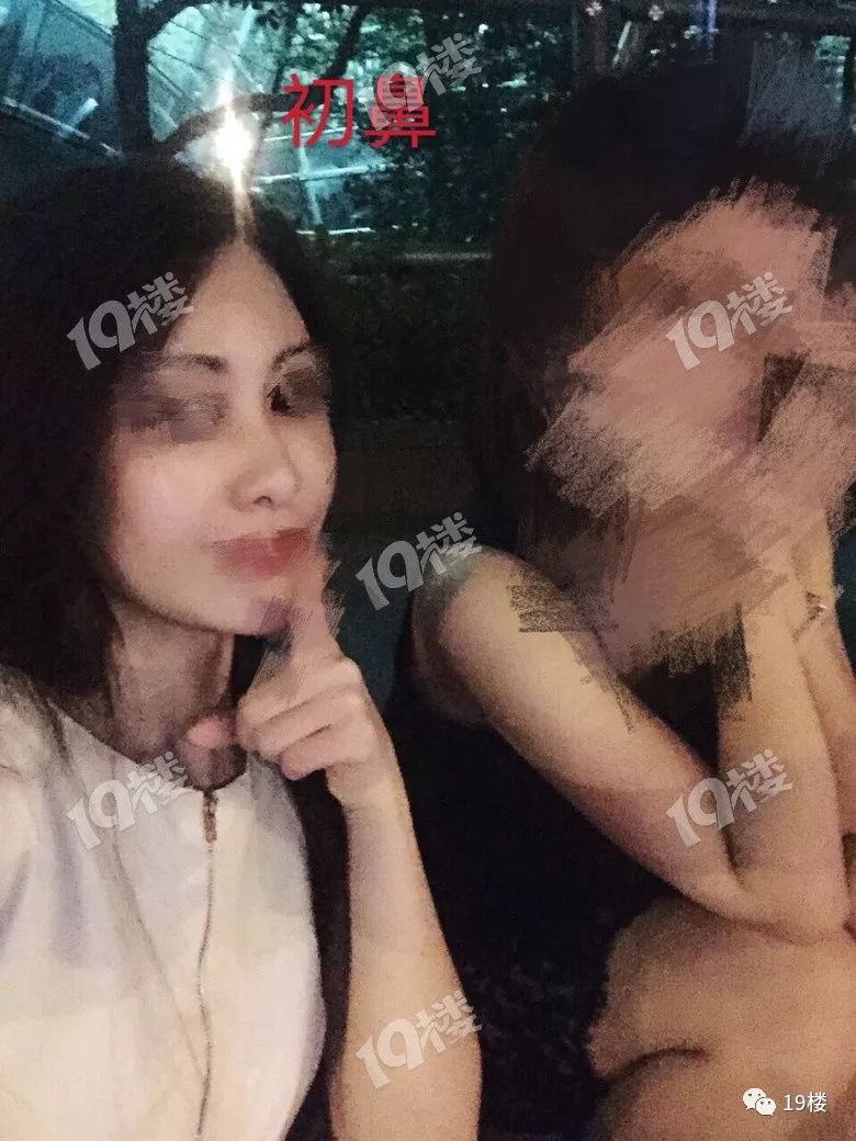 美丽女子整容失败,鼻整形失败多久可以修复