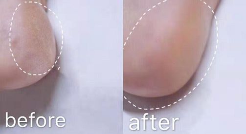 日本人吃饭都不穿鞋，熏死人了！这双耗时3年的黑科技银离子袜，美白润肤自发热，穿7天都不臭脚