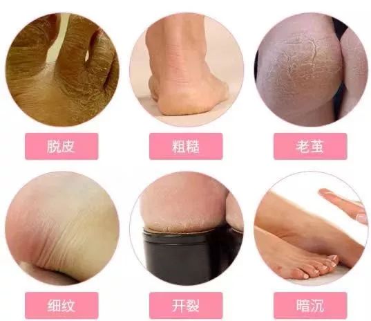 手部护理保养精油,spa护理手套