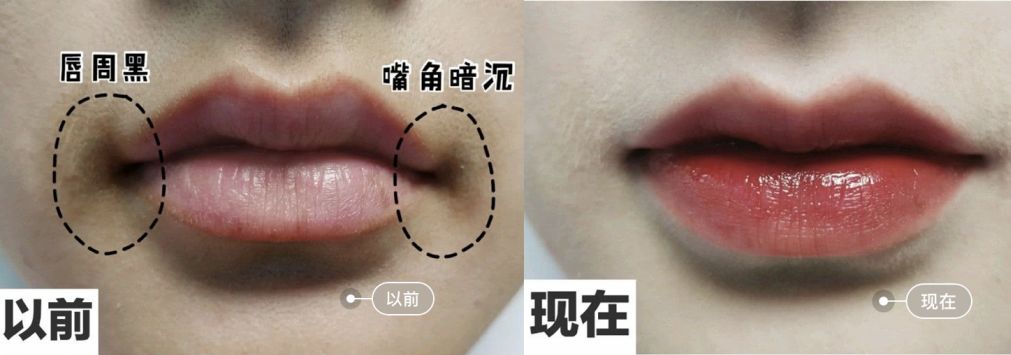 脸上搓下来很多泥,脸上搓出黑头