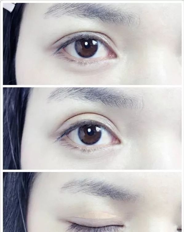 angelababy的双眼皮是什么情况,angelababy的脸整过容吗