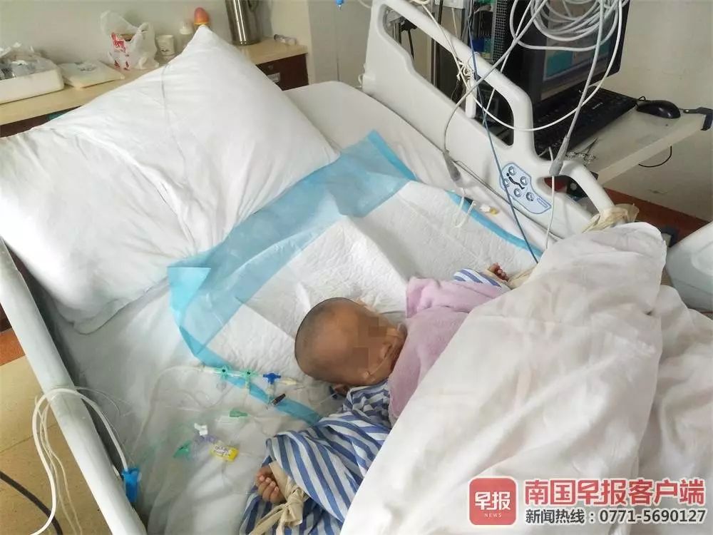 1岁男童患怪病,一岁男婴患罕见怪病