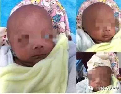 浜戝崡琚栫弽灏忓鍥剧墖,浜戝崡鐪佸垰鍑虹敓鐨勫皬瀹濆疂