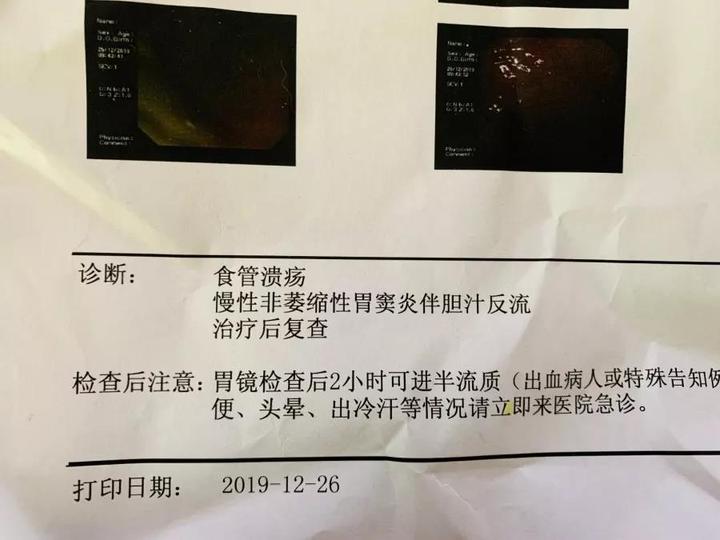 吃甲鱼肚子疼有什么危害,吃甲鱼肚子疼是中毒了吗