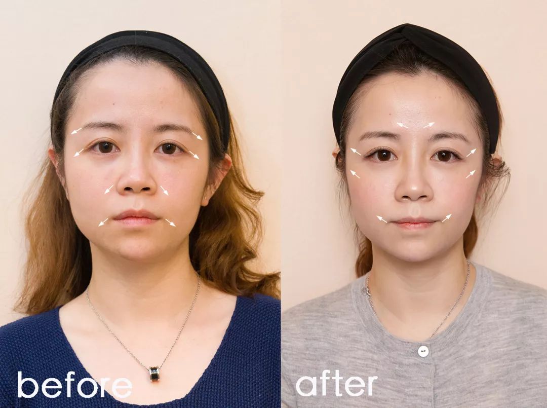 地表最强修复肌肤屏障,地表最强肌诊室