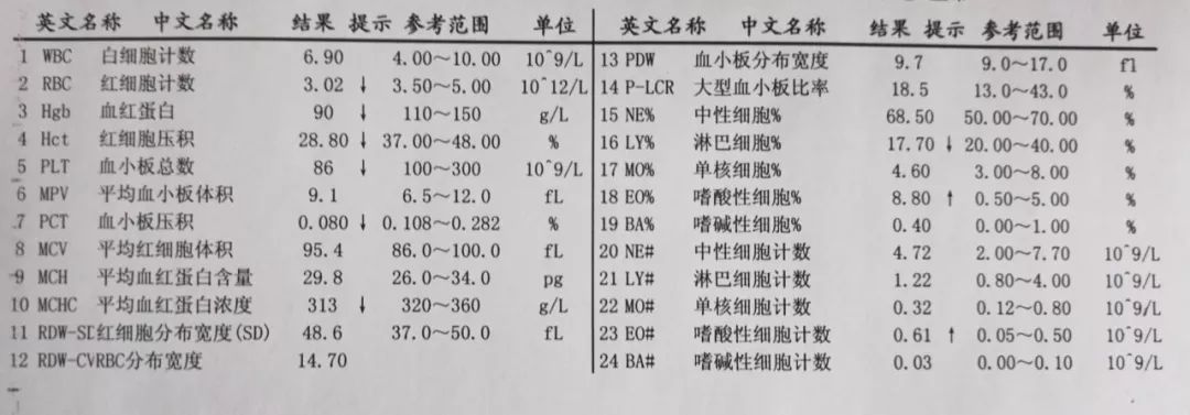 血小板低的原因及危害持续发烧,血小板减低见于什么病