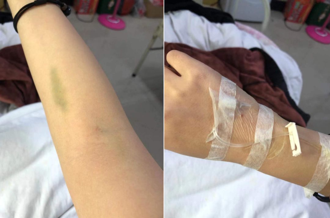 我被确诊到康复都经历了什么,从确诊到死亡仅4个月