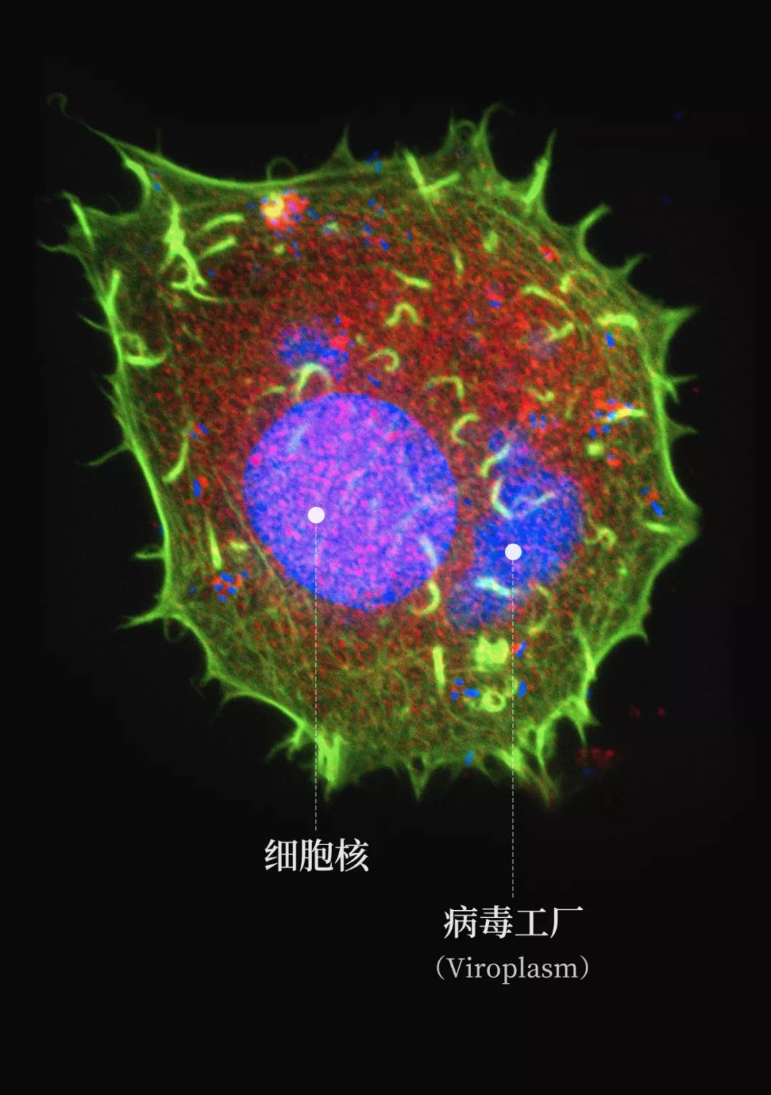 鍋囧鐥呮瘨鎰熸煋浜嗕綘,鍋囧鐥呮瘨鎰熸煋浜嗘垜